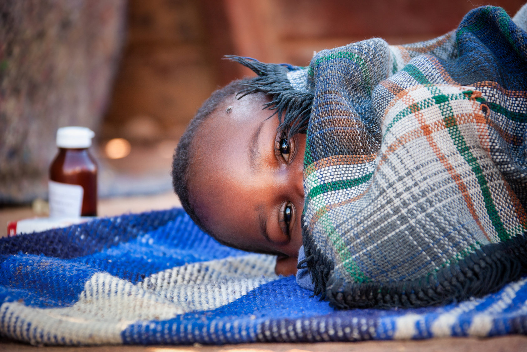 african child toddler sick with malaria